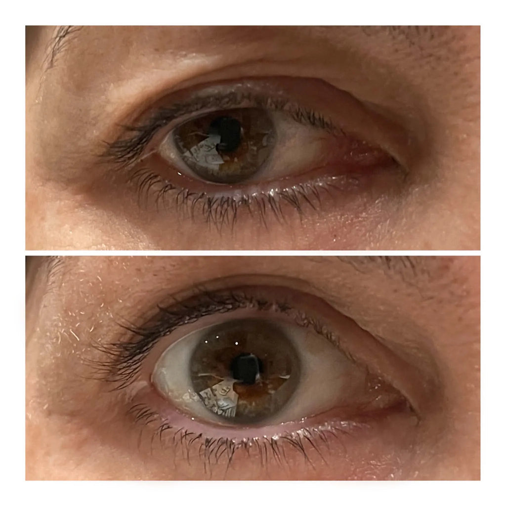 VARITA LIFTING DE OJOS