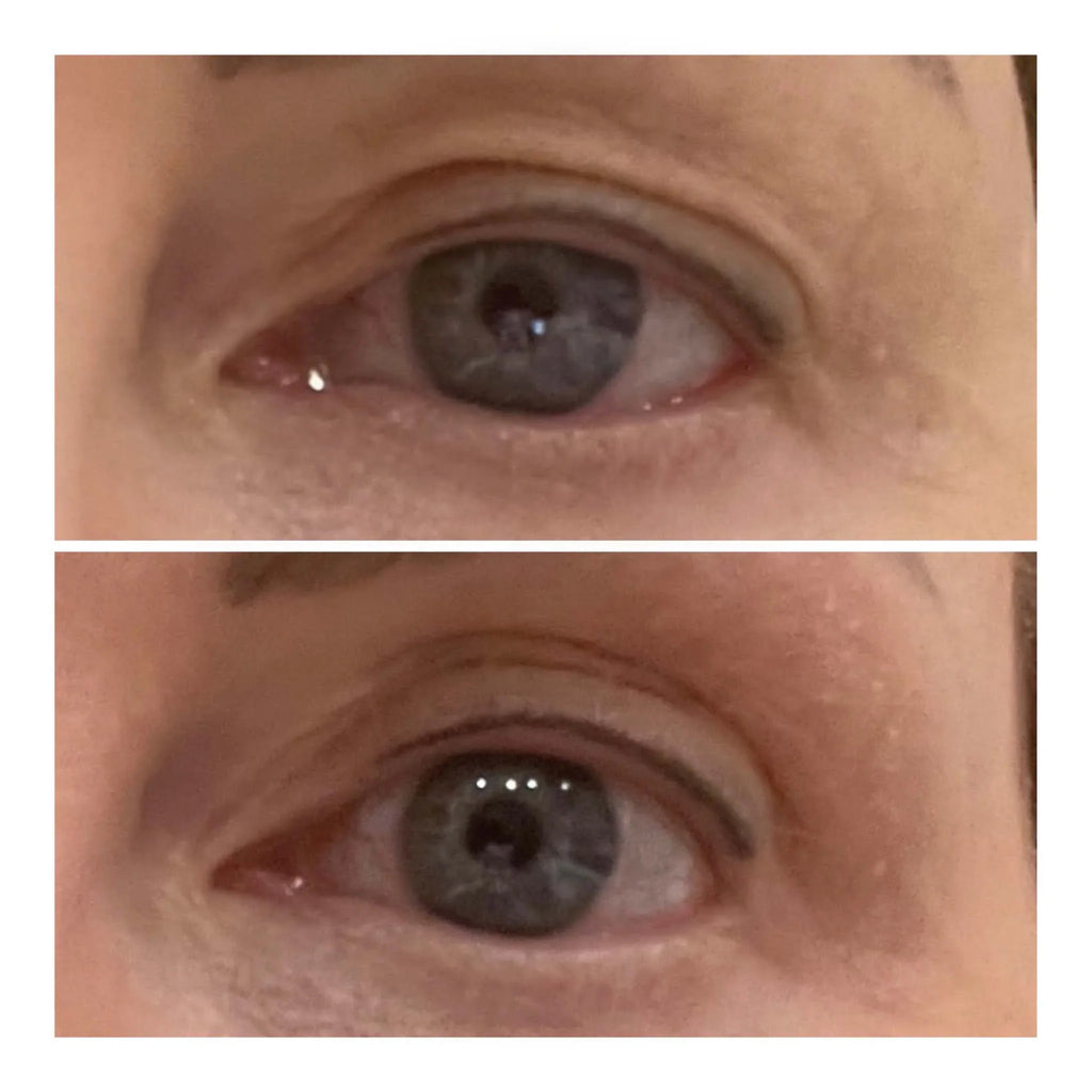 VARITA LIFTING DE OJOS