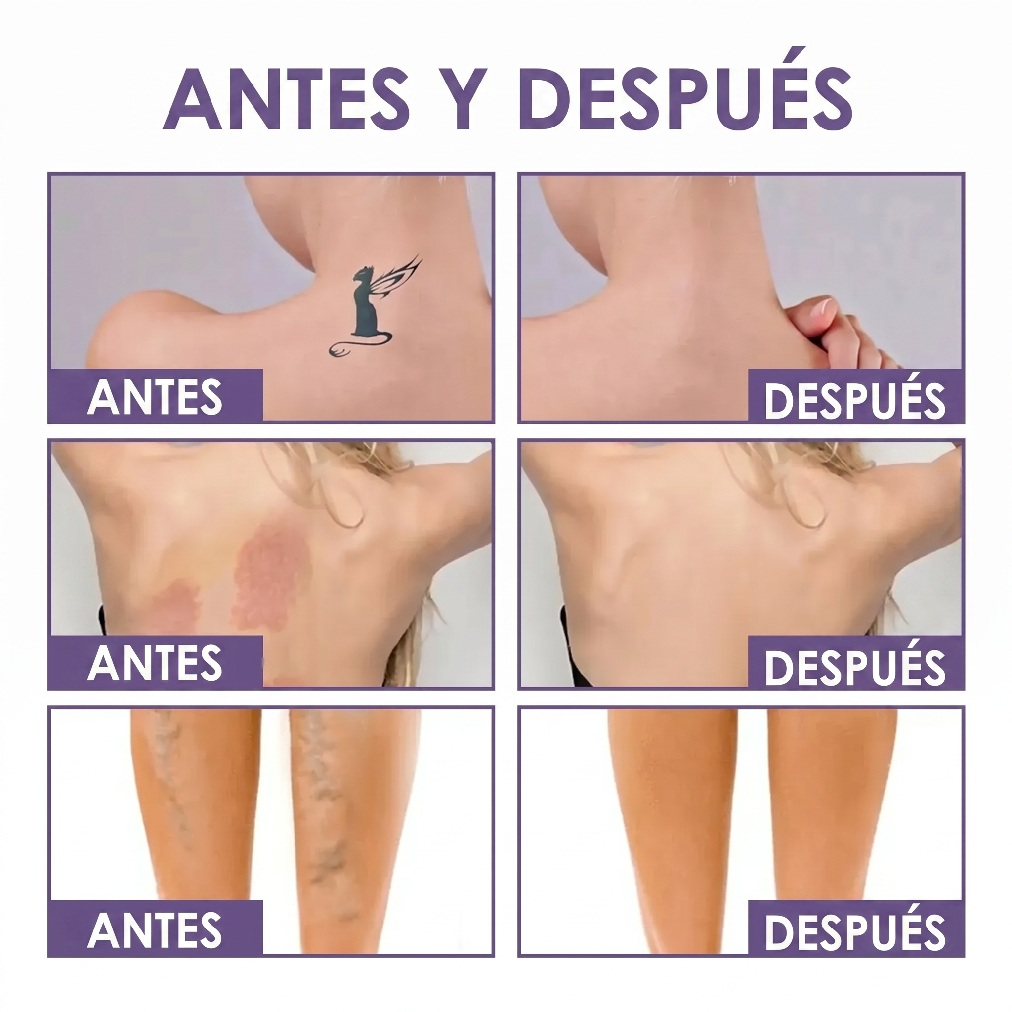 Perfeccionador Corporal