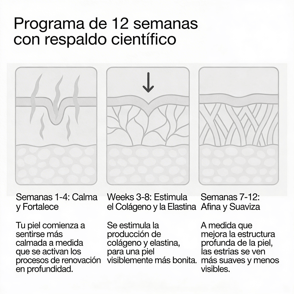 Redefiniendo la crema para estrías